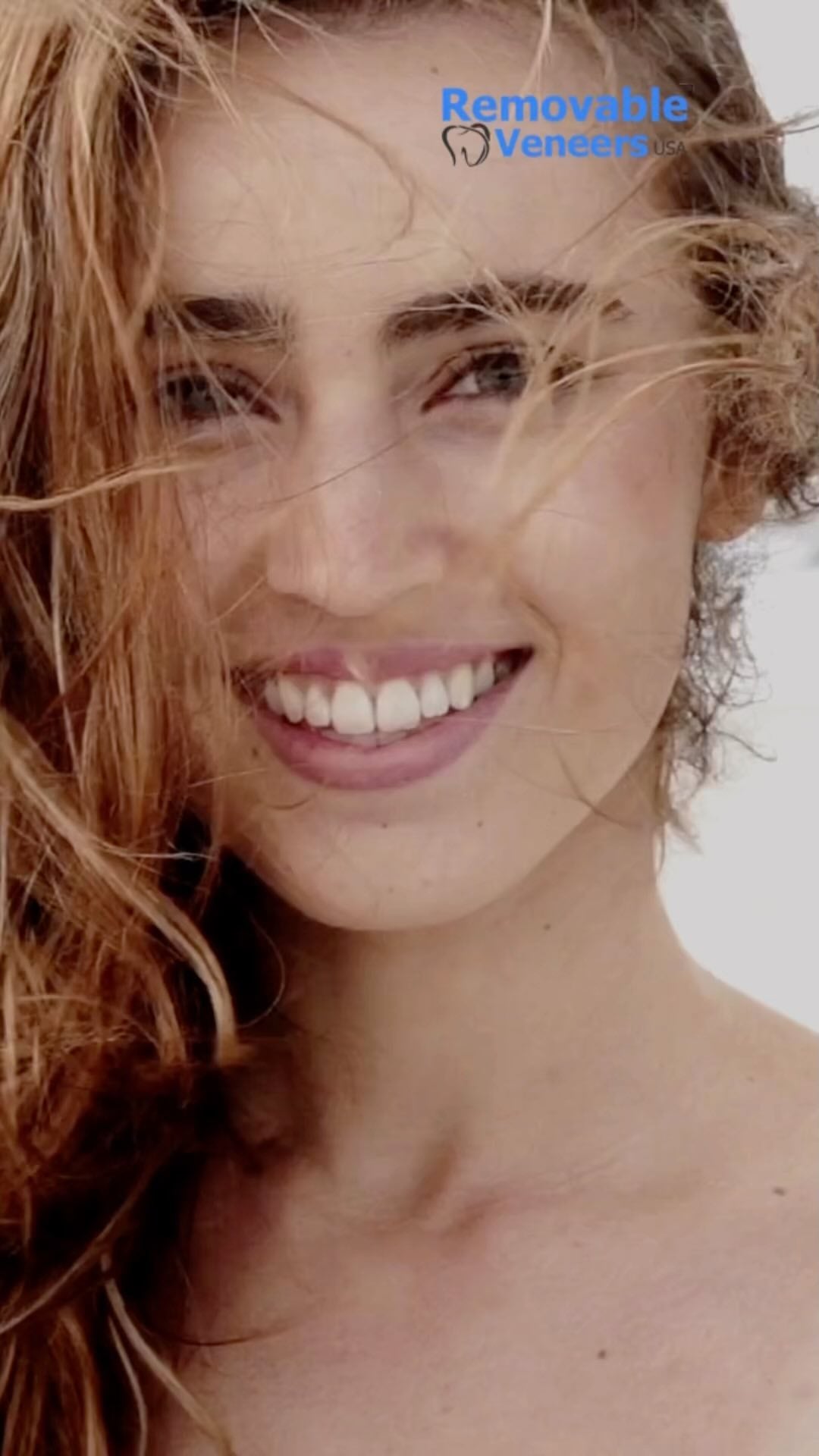 An Affordable Solution for Tooth Implants – Snap On Veneers - removable-veneers