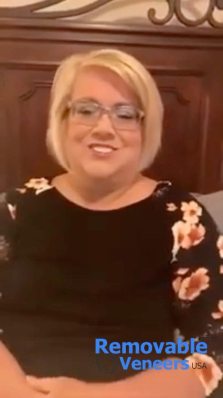 TruSmile Veneers