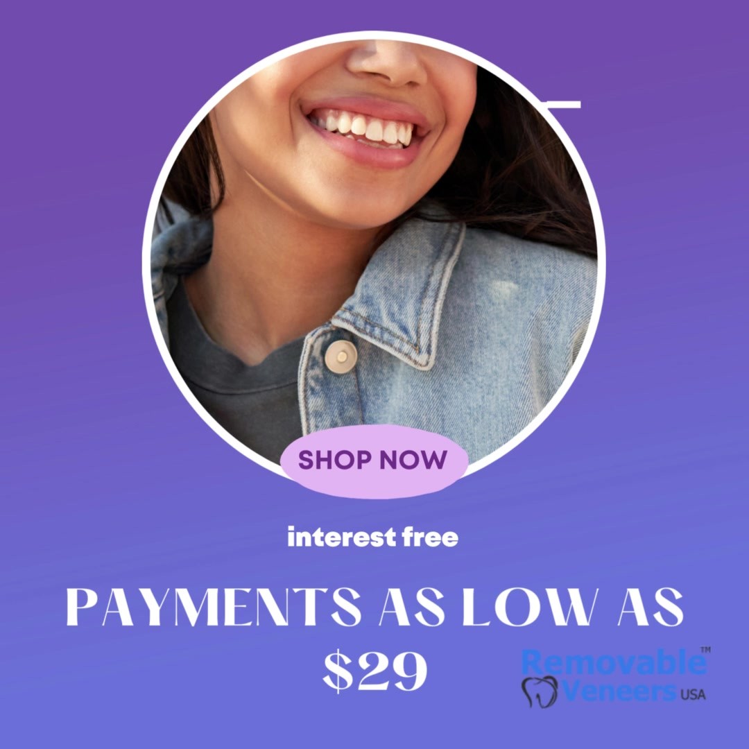 Shiny Smile Veneers