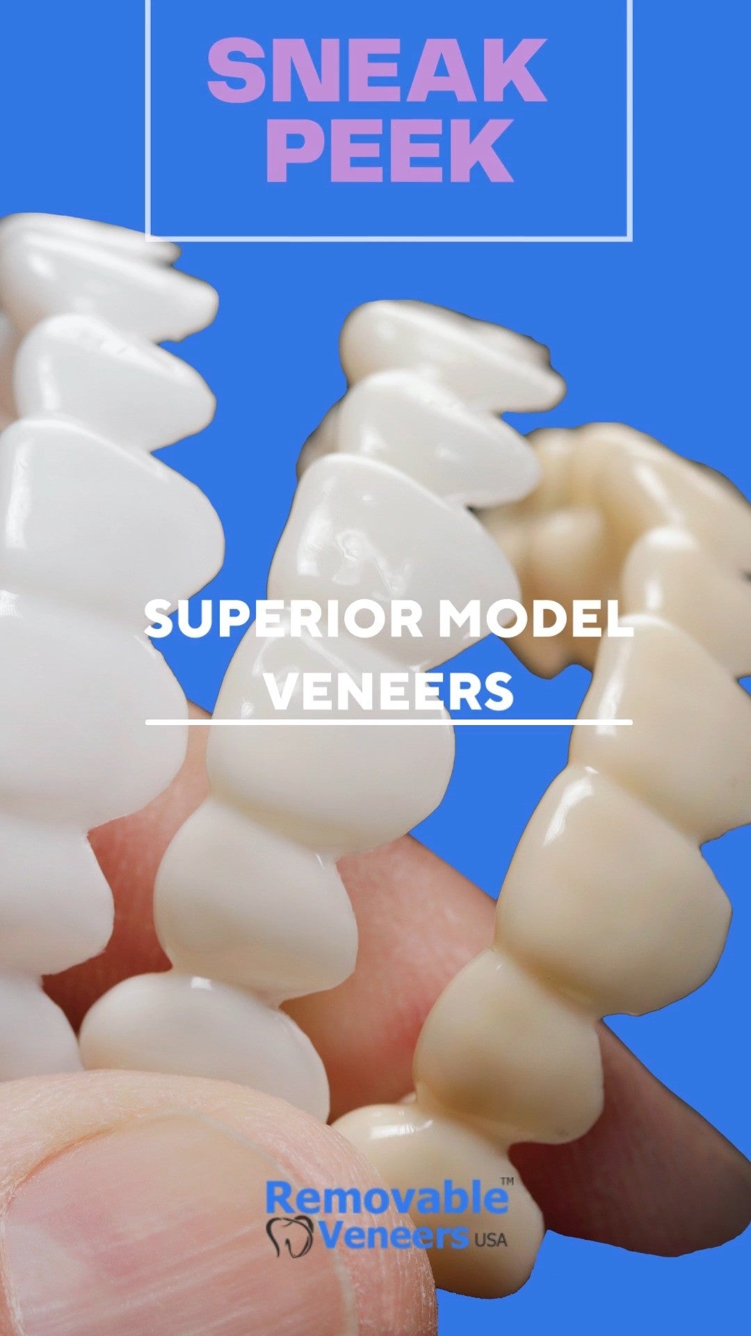 What Does A Smile Say About You - removable-veneers