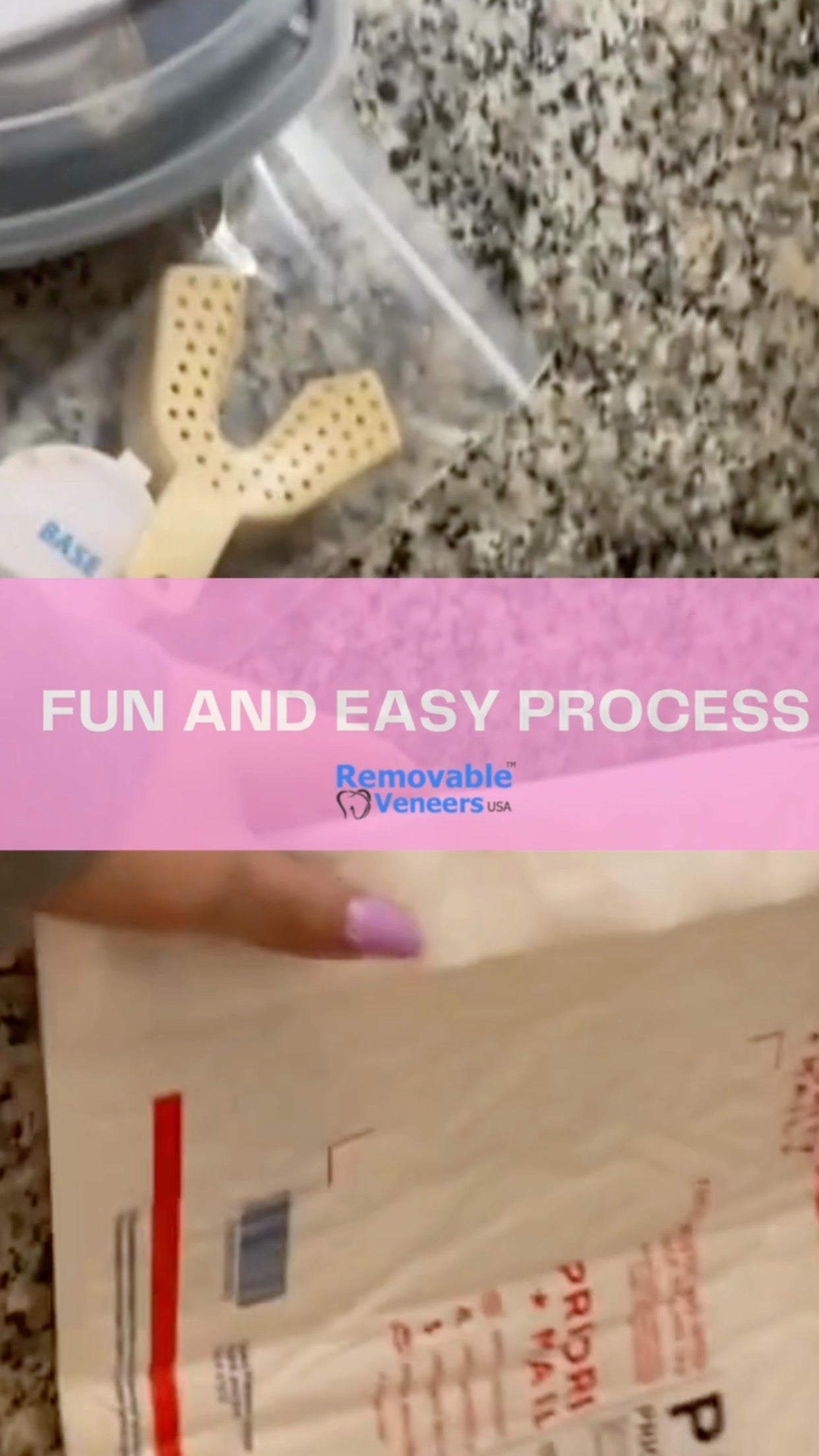 Cosmetic Dental Veneer Alternatives - removable-veneers