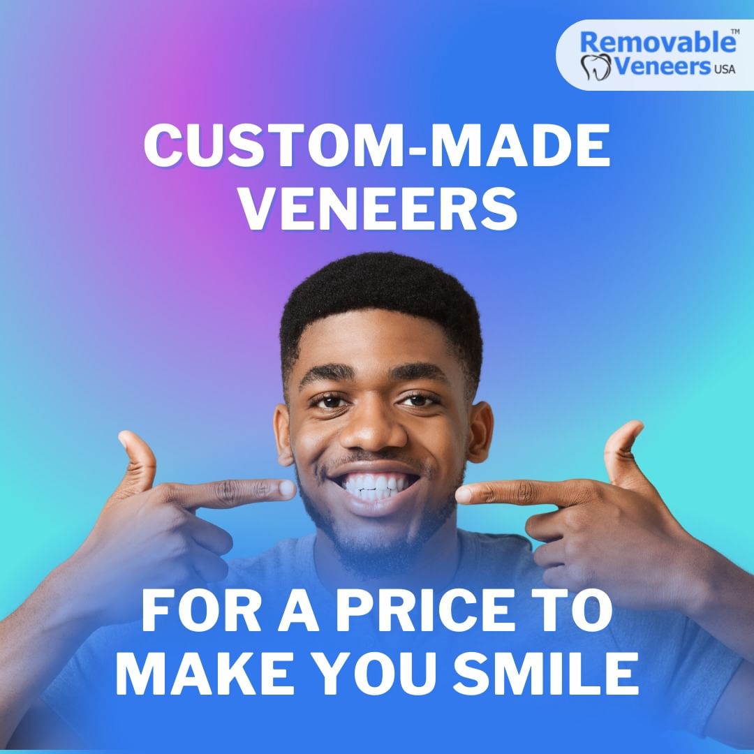 What Are Dental Veneers? Cost, Procedure & Advantages