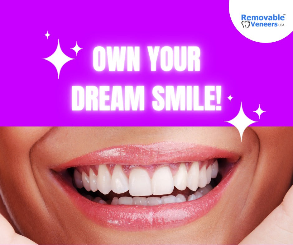 Comparing Top and Bottom Veneers Cost Across Different Dental Practices