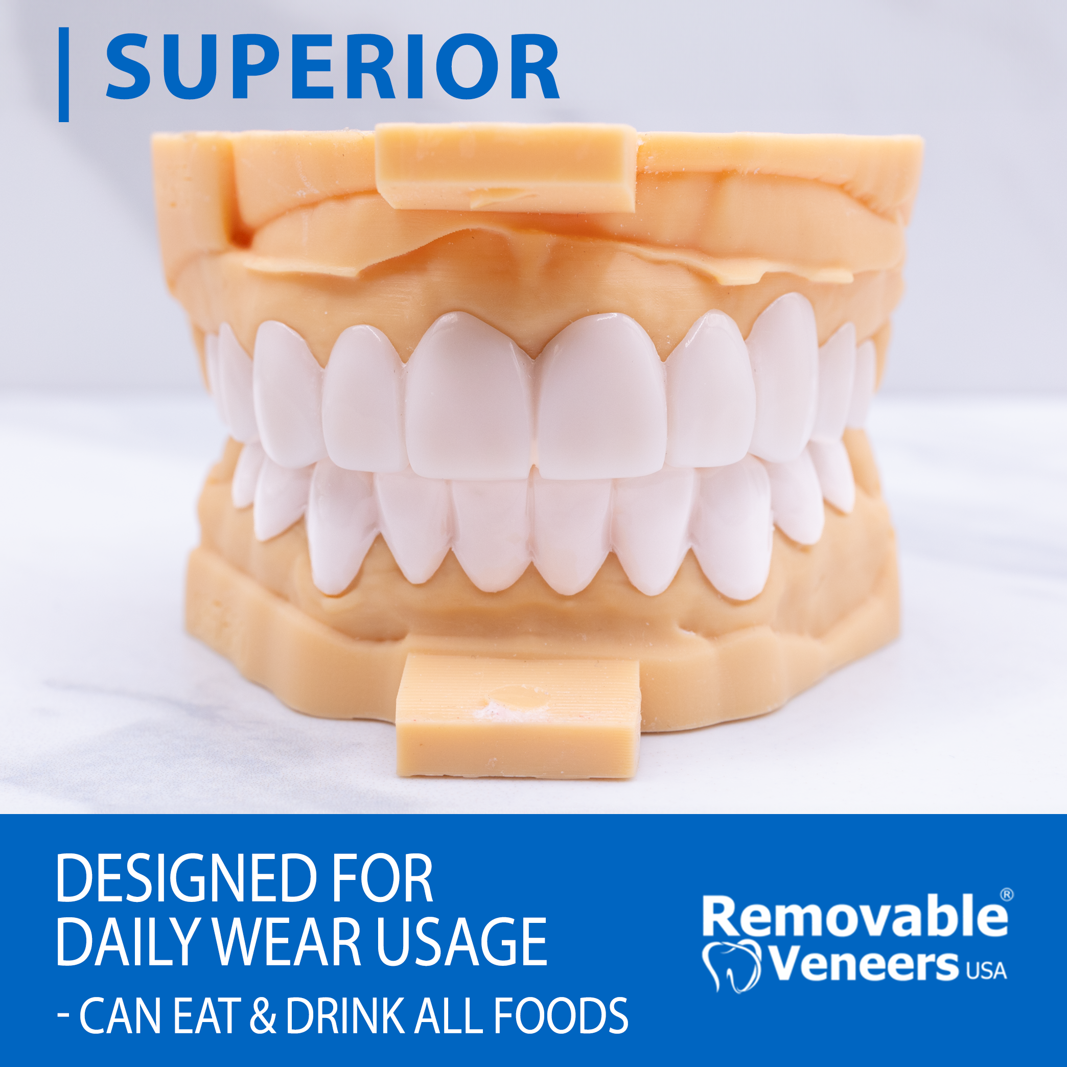 Superior Model Veneers - Designed for Daily Wear Usage - Can Eat & Drink All Foods