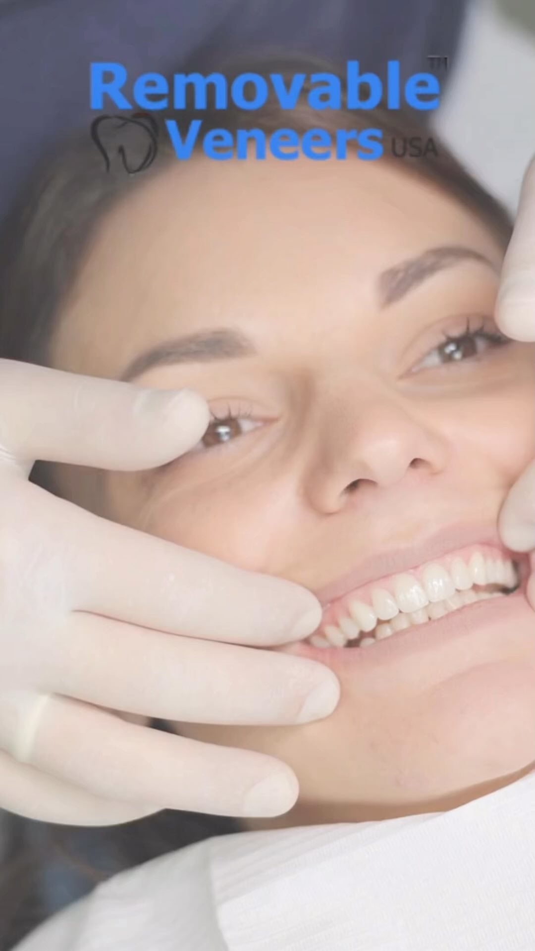 Choosing between Snap-On Veneers and Teeth Whitening: What's the Best Fit for Your Smile