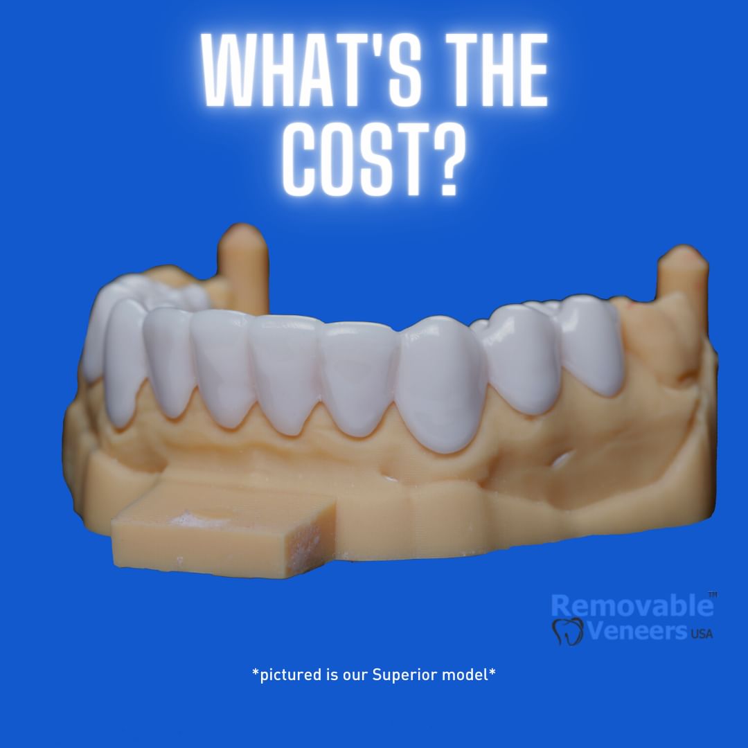 Snap-On Veneers – An Affordable Solution for Dentures? - removable-veneers