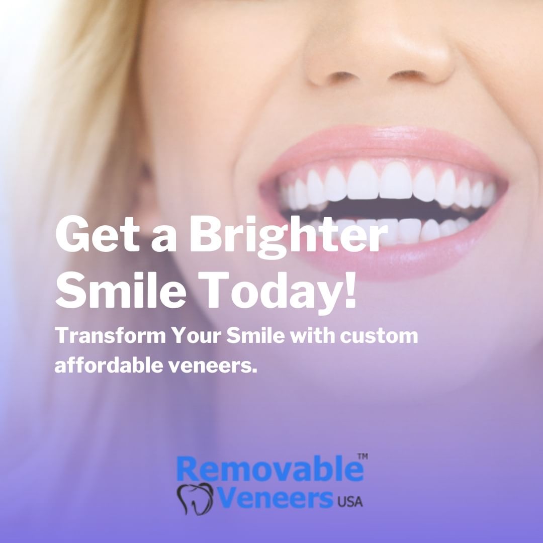 Oral Issues that Can Be Resolved with Veneers: A Comprehensive Guide