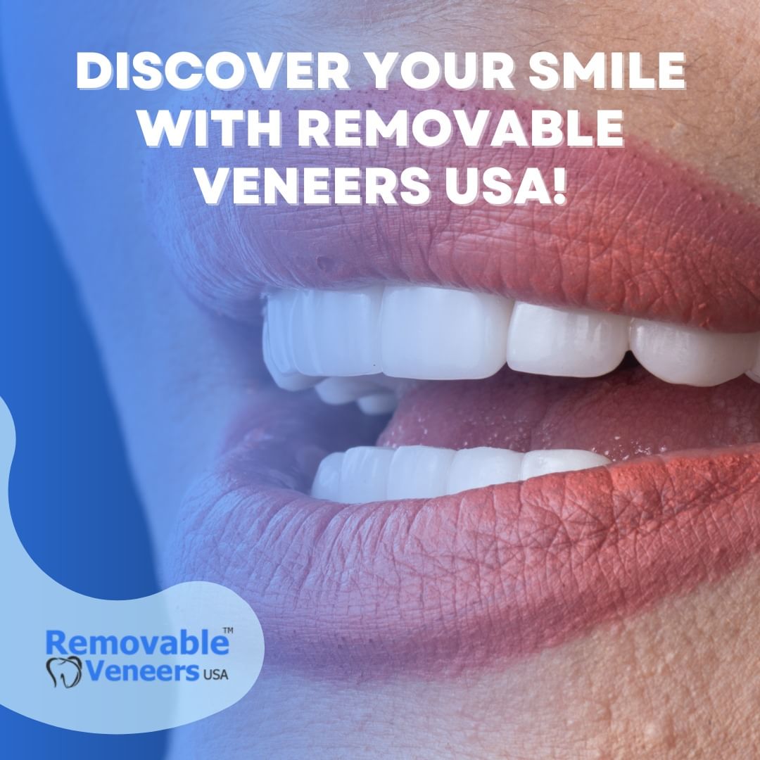Bring Your Smile to Life with Dental Veneers: Unveiling the Magic of Removable Veneers USA
