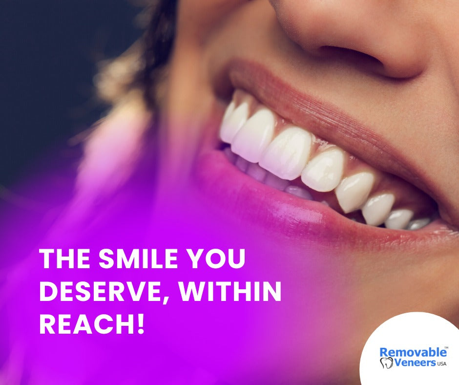 Create a Perfect Smile With Dental Veneers