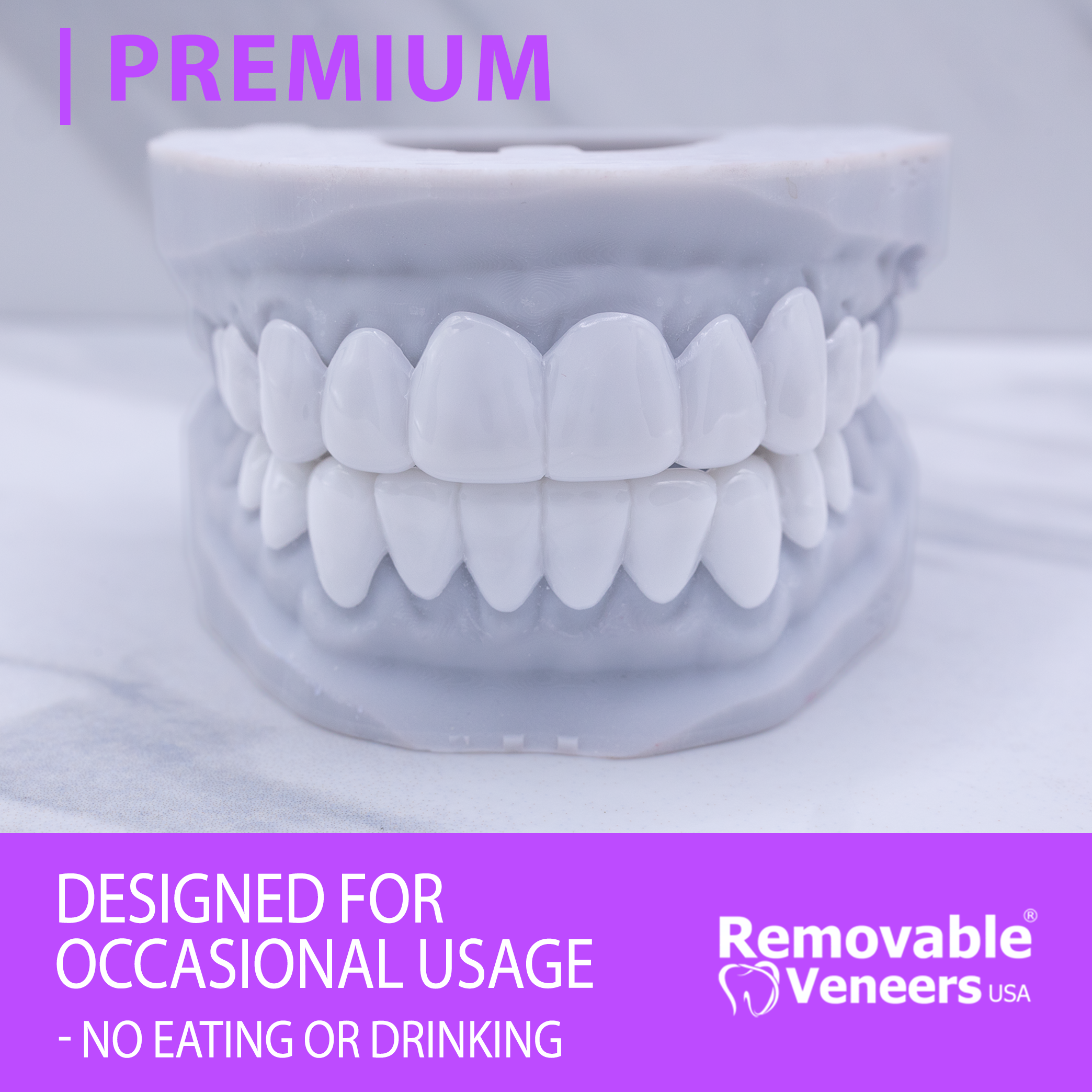 Premium Veneers - Designed for Occasional Wear Usage